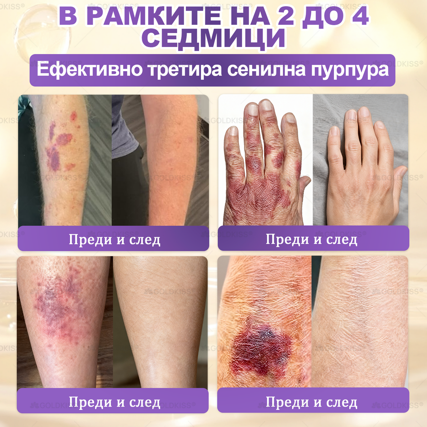 👑Произведено и изпратено от Европа ✨ 𝐆𝐎𝐋𝐃𝐊𝐈𝐒𝐒® 𝐆𝐇𝐊-𝐂𝐮 & 𝐁𝐈𝐎𝐓𝐈𝐍 𝟏𝟎-𝐁-𝟏 Възстановяващ крем за кожата