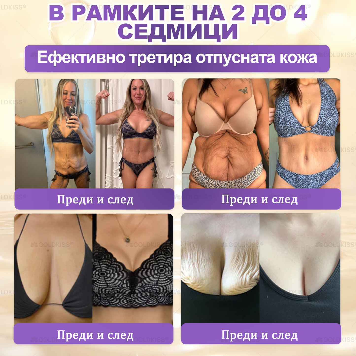 👑Произведено и изпратено от Европа ✨ 𝐆𝐎𝐋𝐃𝐊𝐈𝐒𝐒® 𝐆𝐇𝐊-𝐂𝐮 & 𝐁𝐈𝐎𝐓𝐈𝐍 𝟏𝟎-𝐁-𝟏 Възстановяващ крем за кожата
