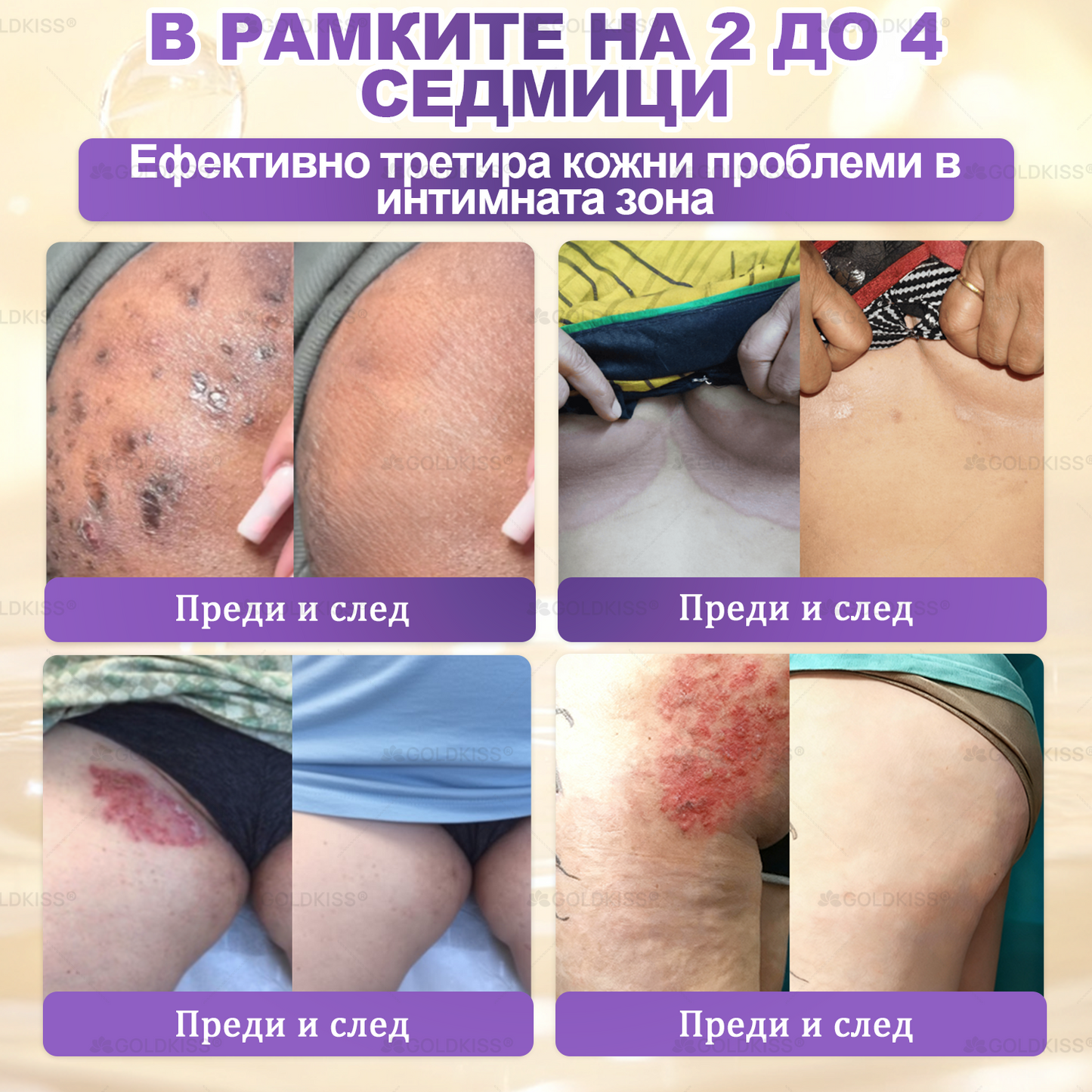 👑Произведено и изпратено от Европа ✨ 𝐆𝐎𝐋𝐃𝐊𝐈𝐒𝐒® 𝐆𝐇𝐊-𝐂𝐮 & 𝐁𝐈𝐎𝐓𝐈𝐍 𝟏𝟎-𝐁-𝟏 Възстановяващ крем за кожата