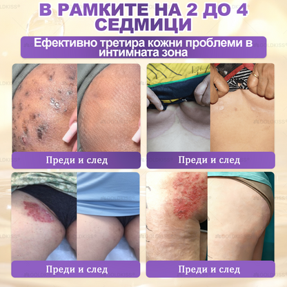 👑Произведено и изпратено от Европа ✨ 𝐆𝐎𝐋𝐃𝐊𝐈𝐒𝐒® 𝐆𝐇𝐊-𝐂𝐮 & 𝐁𝐈𝐎𝐓𝐈𝐍 𝟏𝟎-𝐁-𝟏 Възстановяващ крем за кожата