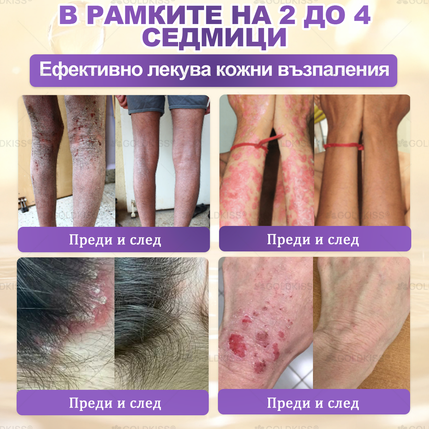 👑Произведено и изпратено от Европа ✨ 𝐆𝐎𝐋𝐃𝐊𝐈𝐒𝐒® 𝐆𝐇𝐊-𝐂𝐮 & 𝐁𝐈𝐎𝐓𝐈𝐍 𝟏𝟎-𝐁-𝟏 Възстановяващ крем за кожата