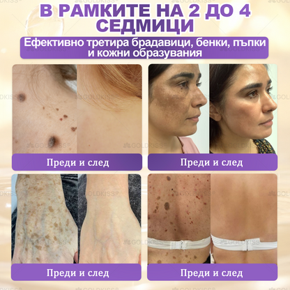 👑Произведено и изпратено от Европа ✨ 𝐆𝐎𝐋𝐃𝐊𝐈𝐒𝐒® 𝐆𝐇𝐊-𝐂𝐮 & 𝐁𝐈𝐎𝐓𝐈𝐍 𝟏𝟎-𝐁-𝟏 Възстановяващ крем за кожата