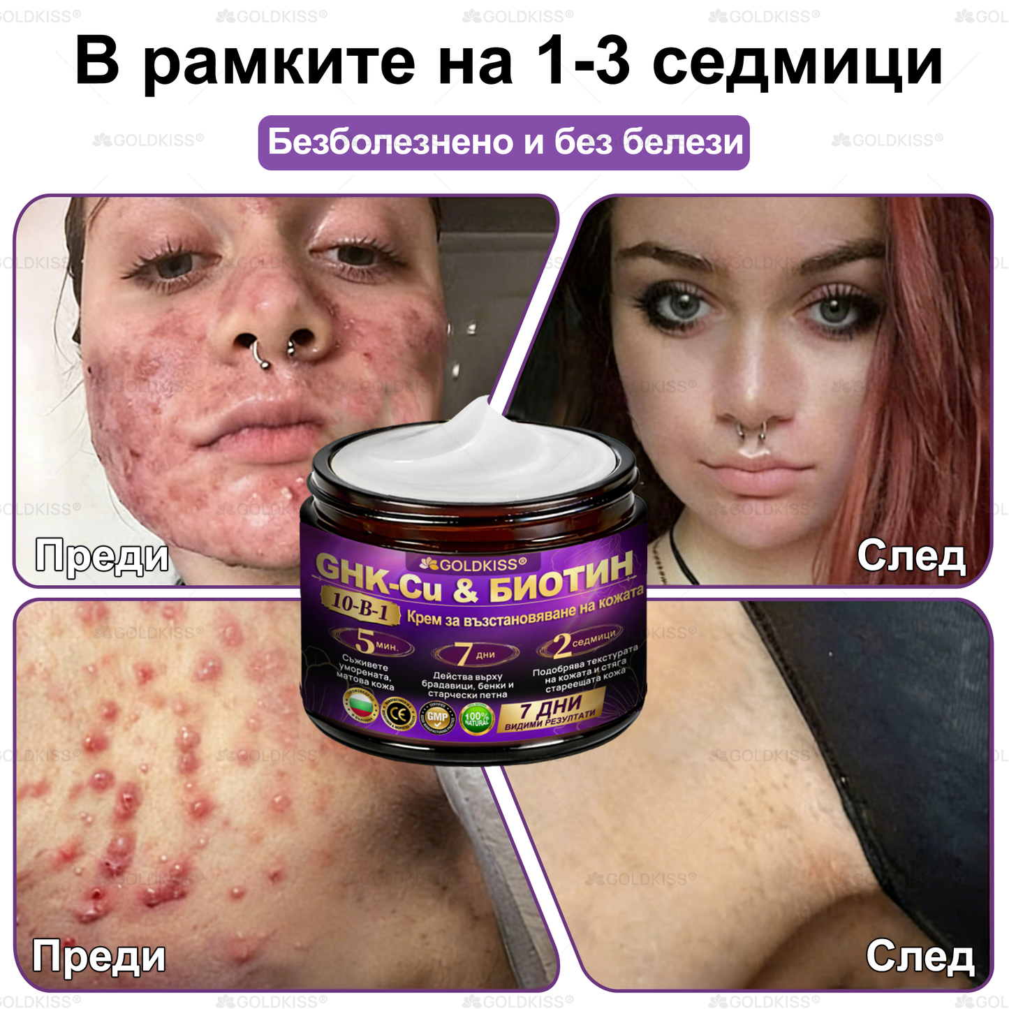 👑Произведено и изпратено от Европа ✨ 𝐆𝐎𝐋𝐃𝐊𝐈𝐒𝐒® 𝐆𝐇𝐊-𝐂𝐮 & 𝐁𝐈𝐎𝐓𝐈𝐍 𝟏𝟎-𝐁-𝟏 Възстановяващ крем за кожата