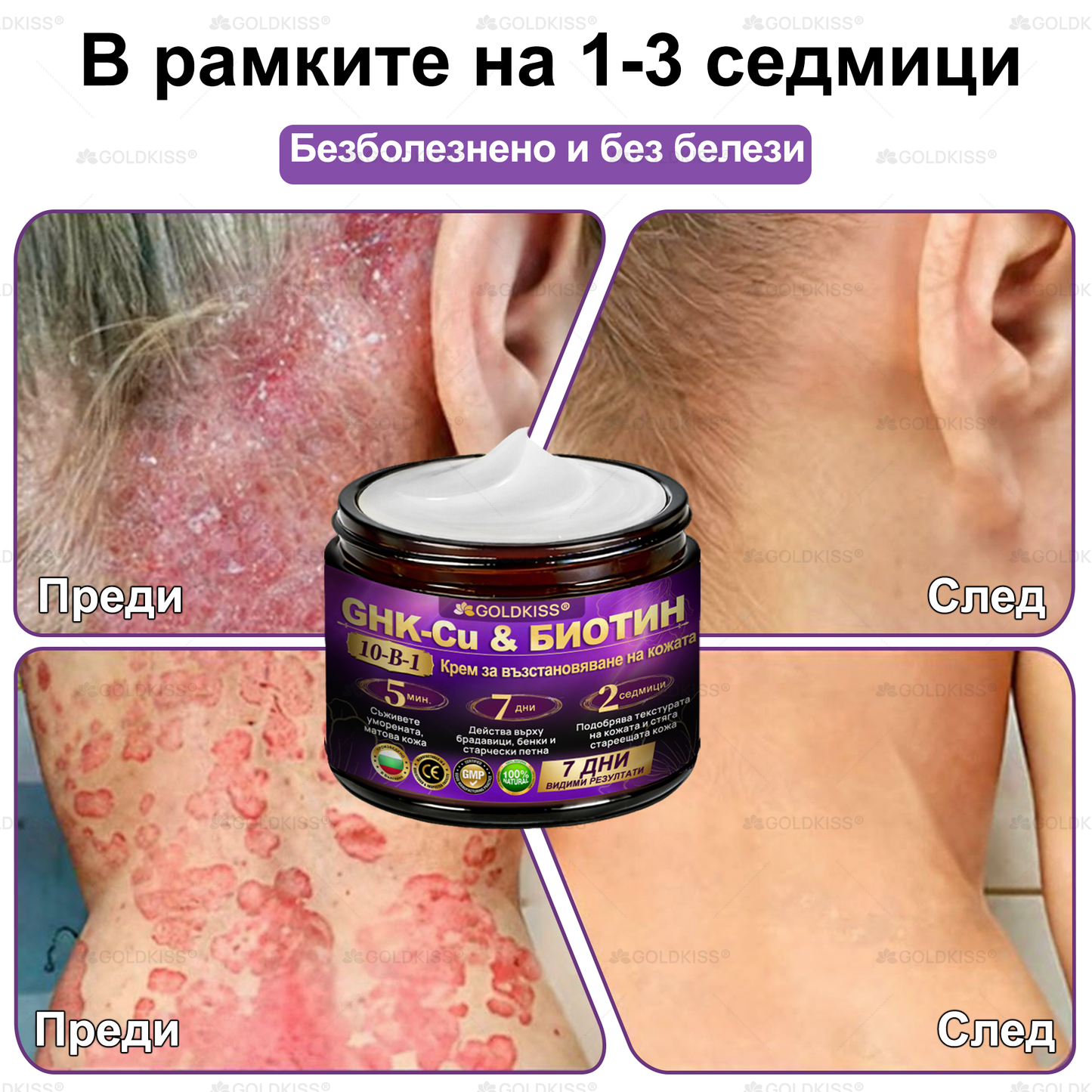 👑Произведено и изпратено от Европа ✨ 𝐆𝐎𝐋𝐃𝐊𝐈𝐒𝐒® 𝐆𝐇𝐊-𝐂𝐮 & 𝐁𝐈𝐎𝐓𝐈𝐍 𝟏𝟎-𝐁-𝟏 Възстановяващ крем за кожата