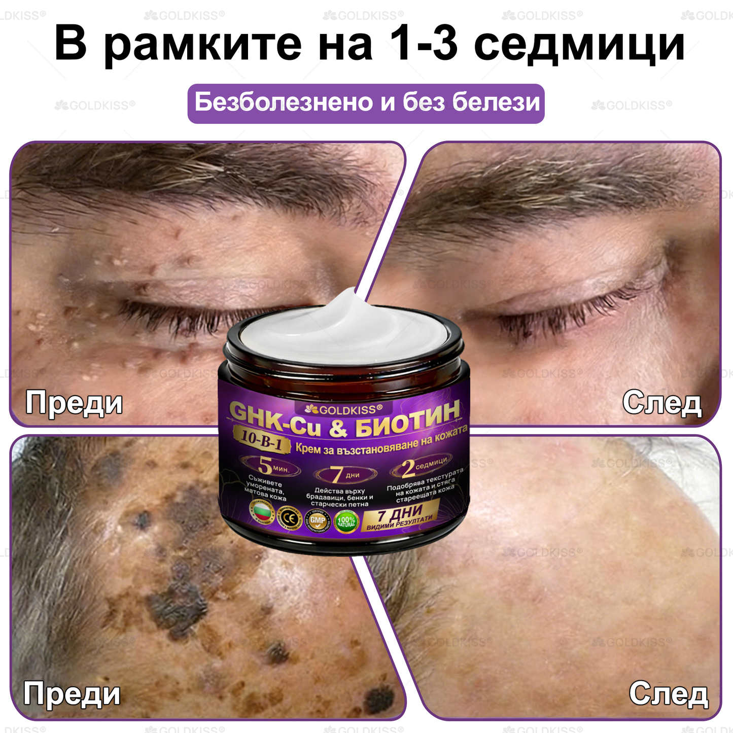 👑Произведено и изпратено от Европа ✨ 𝐆𝐎𝐋𝐃𝐊𝐈𝐒𝐒® 𝐆𝐇𝐊-𝐂𝐮 & 𝐁𝐈𝐎𝐓𝐈𝐍 𝟏𝟎-𝐁-𝟏 Възстановяващ крем за кожата