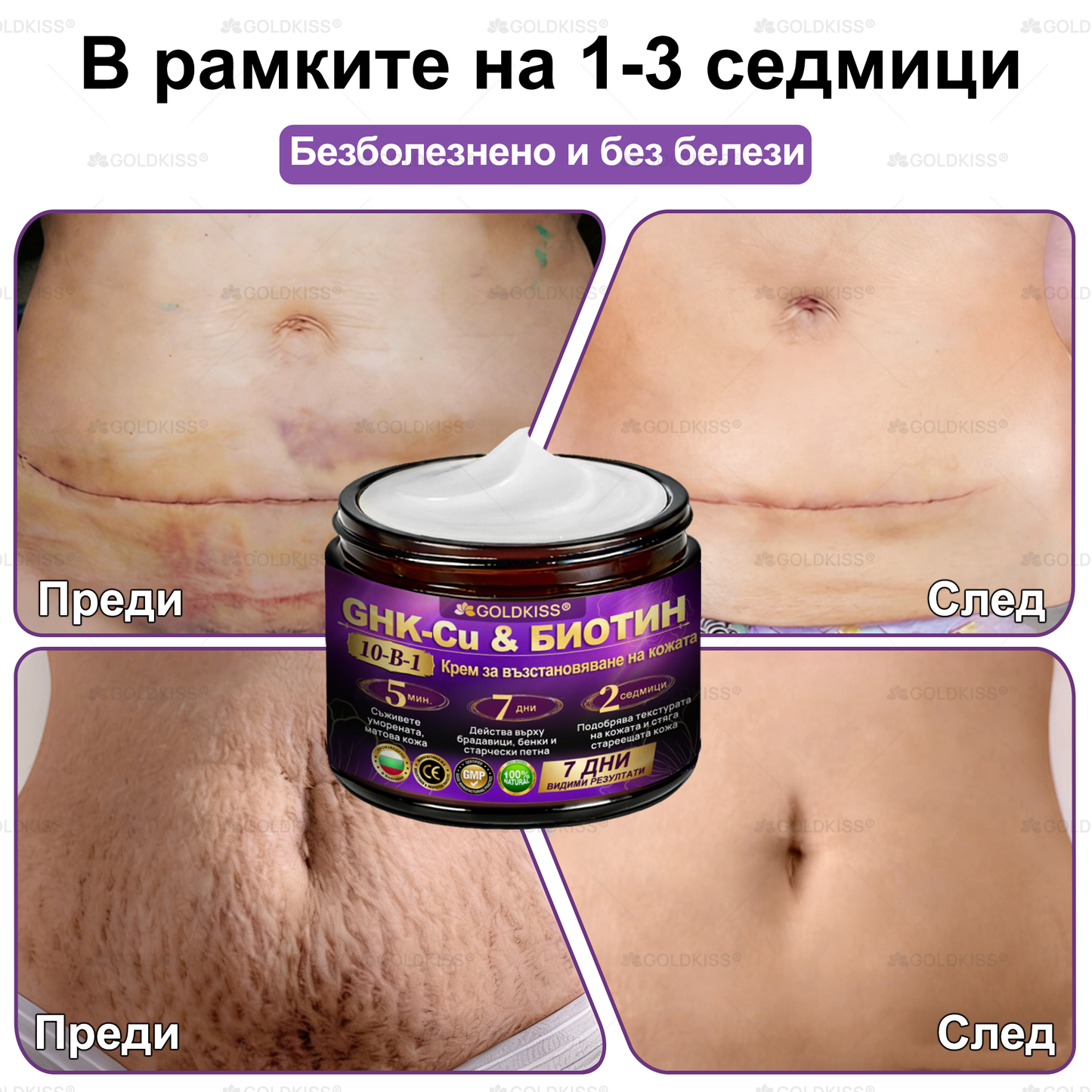 👑Произведено и изпратено от Европа ✨ 𝐆𝐎𝐋𝐃𝐊𝐈𝐒𝐒® 𝐆𝐇𝐊-𝐂𝐮 & 𝐁𝐈𝐎𝐓𝐈𝐍 𝟏𝟎-𝐁-𝟏 Възстановяващ крем за кожата