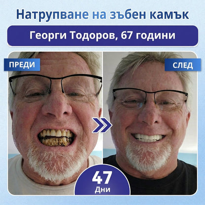 💫 Кажете сбогом на чувствителността и дискомфорта! 𝐂𝐨𝐚𝐮𝐨𝐨® Tideglusib орални ленти – бързо възстановяване за зъби и венци 😊