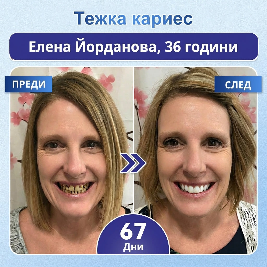 💫 Кажете сбогом на чувствителността и дискомфорта! 𝐂𝐨𝐚𝐮𝐨𝐨® Tideglusib орални ленти – бързо възстановяване за зъби и венци 😊