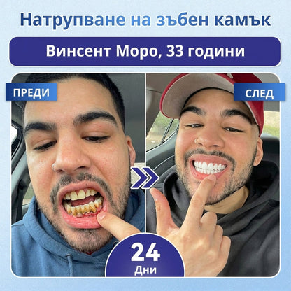 💫 Кажете сбогом на чувствителността и дискомфорта! 𝐂𝐨𝐚𝐮𝐨𝐨® Tideglusib орални ленти – бързо възстановяване за зъби и венци 😊